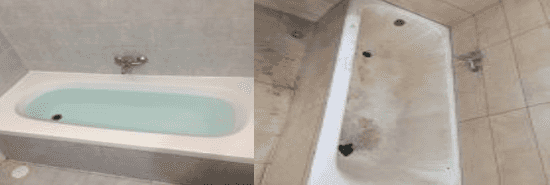 הלבשת אמבטיה: מה חשוב לדעת?