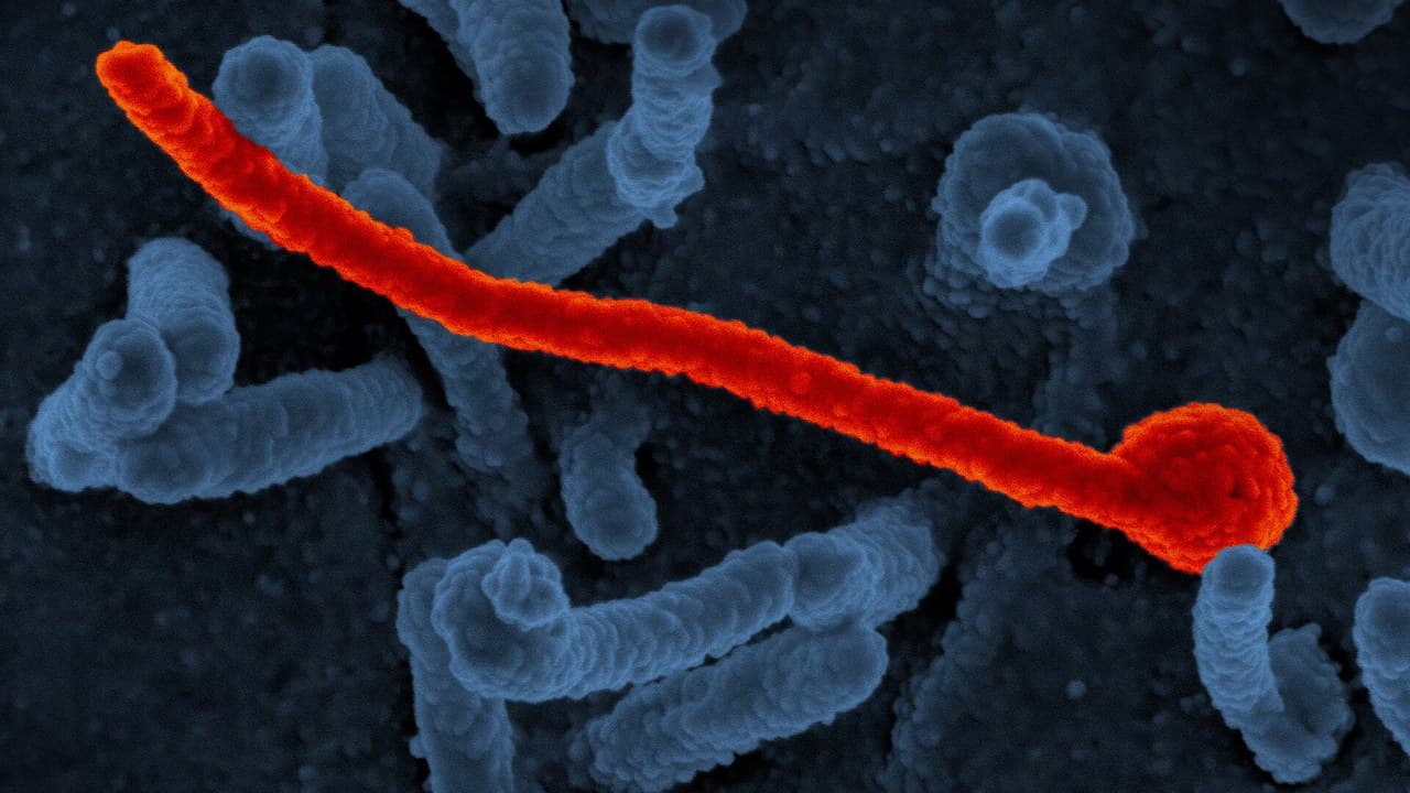 בצל התפרצות האבולה הקשה בהיסטוריה: מקרה של אבעבועות קוף אומת במזרח קונגו